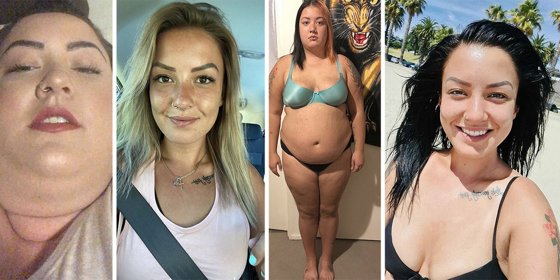 Young woman loses over 150 lbs and completely changes her life after having Gastric  Sleeve Surgery